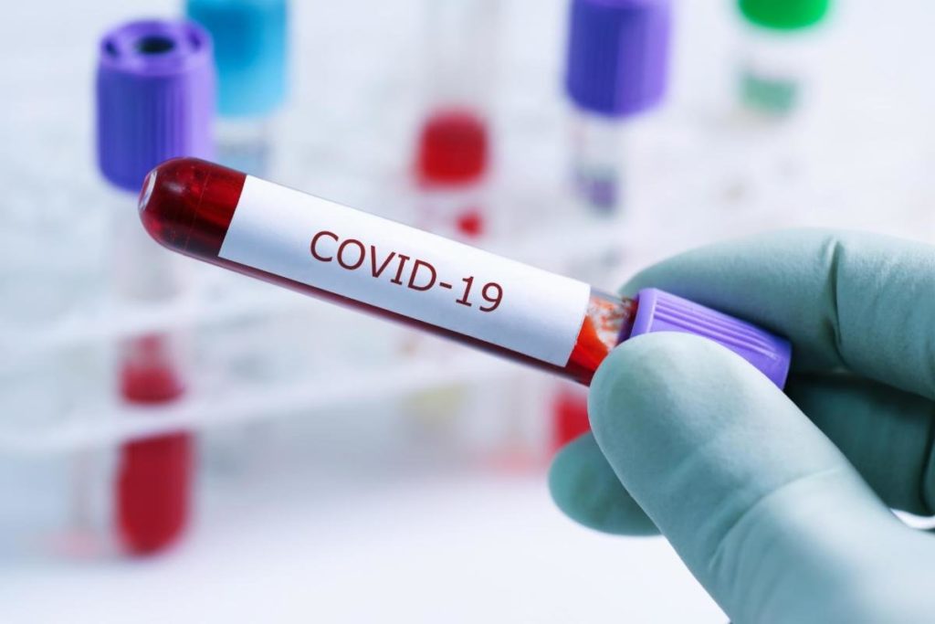 Shkon në 186 numri i të prekurve me Covid-19 në Shqipëri