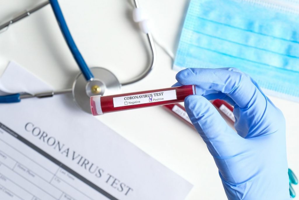 Dyshimet për koronavirus, nxënësit shqiptarë alarmojnë shkollën në Greqi