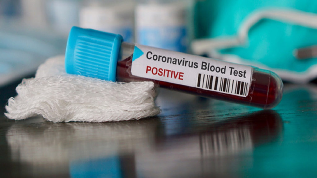 Moderatori i famshëm italian dhe nëna e tij infektohen me Koronavirus!