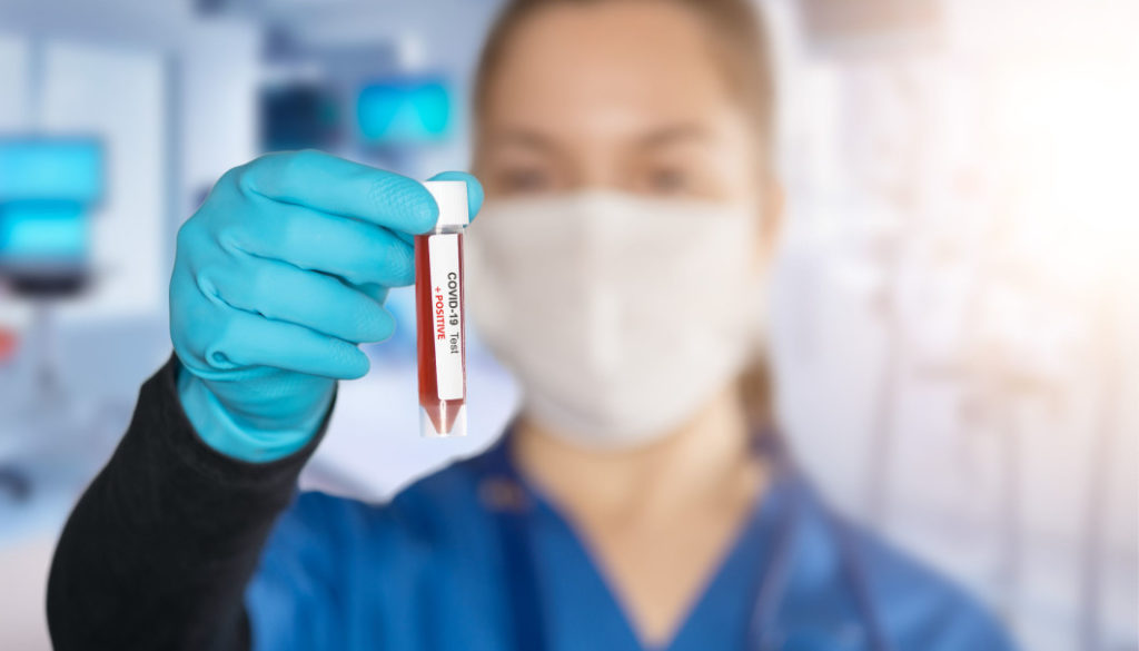 Tre raste të reja me Coronavirus në vendin tonë, mes tyre një 33-vjeçar në gjendje të rëndë