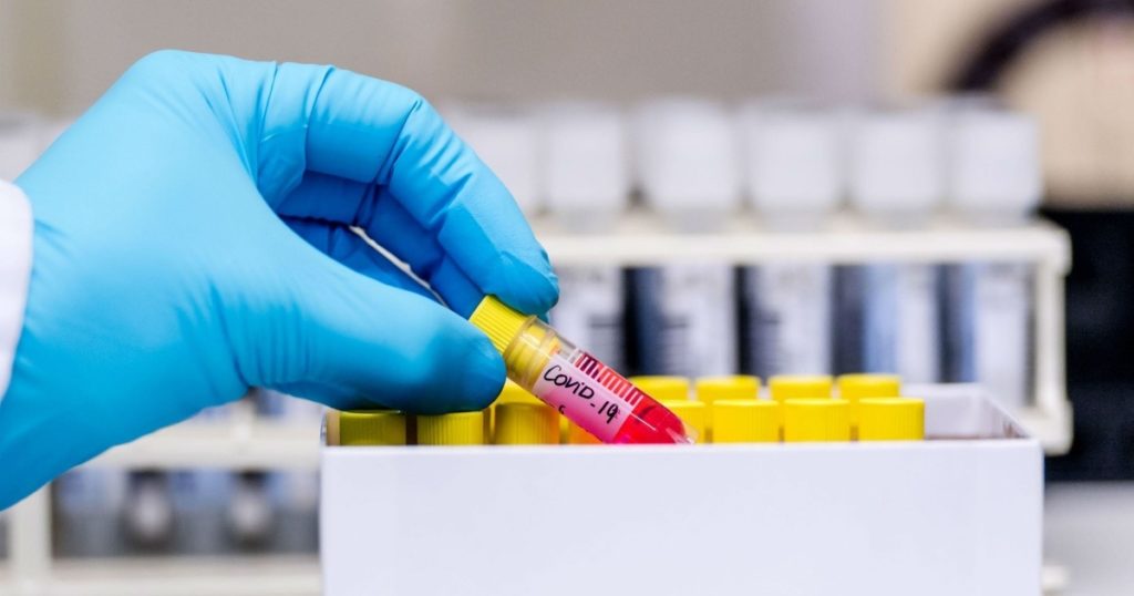 Rasti i dytë me koronavirus në Shkodër, i infektuar oficeri i Policisë Gjyqësore