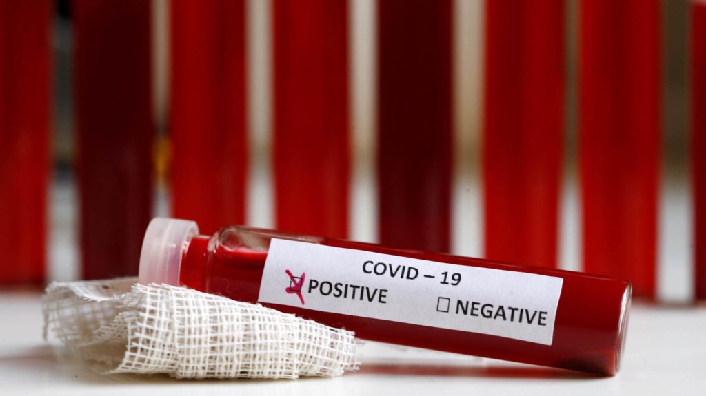 Ulje e lehtë e viktimave nga COVID-19 në Spanjë, 44 më pak se një ditë më parë