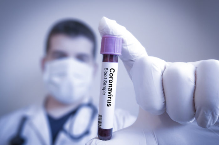 Koronavirusi: Rritet numri i viktimave në Shtetet e Bashkuara të Amerikës dhe Britaninë e Madhe