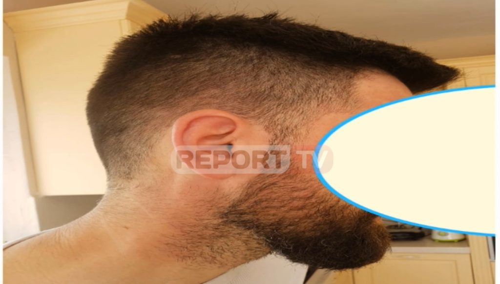 Po filmonte arrestimin e Alfred Lelës, dhunohet nga efektivët operatori i “Report Tv” (VIDEO)