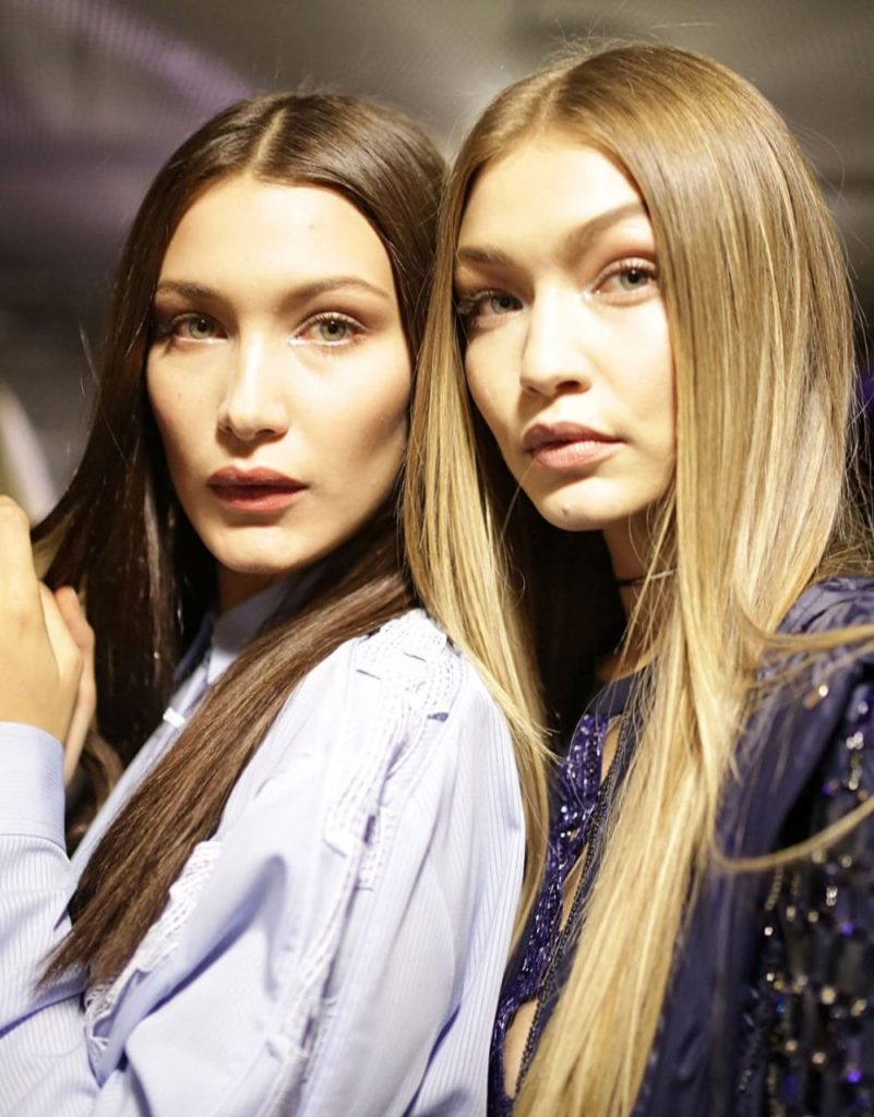 Ups! Pas videos që bëri namin, ekspertët tregojnë ndërhyrjet estetike të motrave Hadid