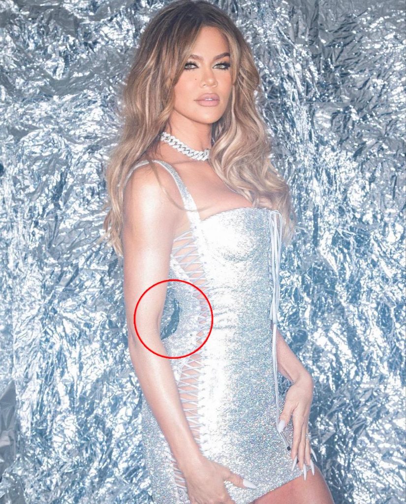 Khloe Kardashian dështon sërish me fotoshopin, fansat ‘e detyrojnë’ të fshijë fotot