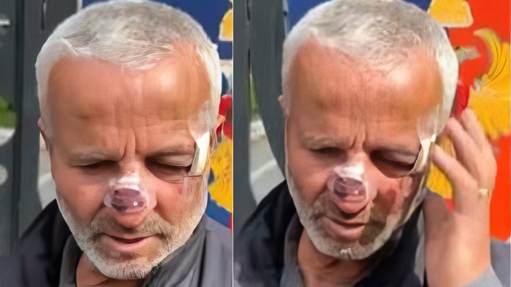 “Gjej 10 vota për PS”/ Refuzoi të plotësonte formularin, dhunohet punonjësi i Bashkisë në Patos