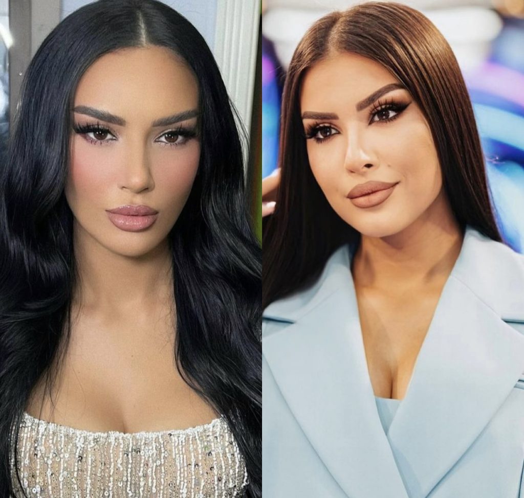 Bora apo Elita? Dy vajzat bëhen “matchy” me trendin e ri të flokëve, s’dimë kujt i shkon më shumë