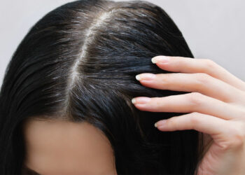 Gjërat që duhet të dini për thinjat!