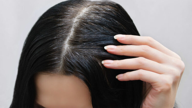 Gjërat që duhet të dini për thinjat!