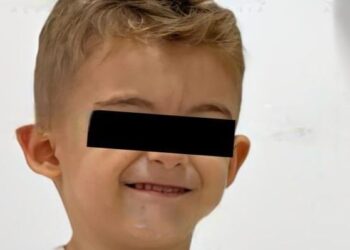Lemeria në Tiranë! 3-vjeçari ndërron jetë nga narkoza e dentistit