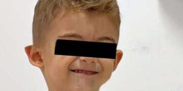 Lemeria në Tiranë! 3-vjeçari ndërron jetë nga narkoza e dentistit