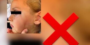 Flokë të shkulura dhe shenja shpulle në fytyrë, tjetër rast dhune në Durrës