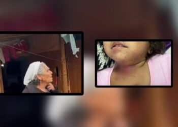 Gjyshja e 2-vjeçares që u dogj me cigare: E ka gjuajtur i vëllai pa dashje