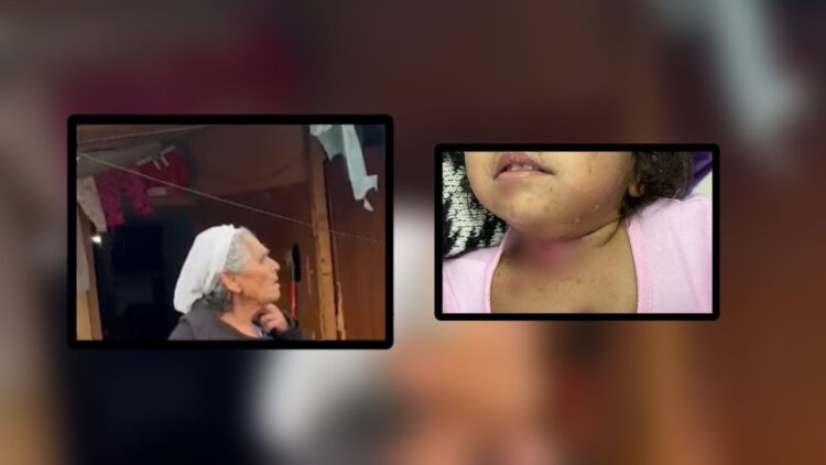 Gjyshja e 2-vjeçares që u dogj me cigare: E ka gjuajtur i vëllai pa dashje