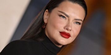 Pjesë e trendit? Adriana Lima flet rreth operacioneve plastike
