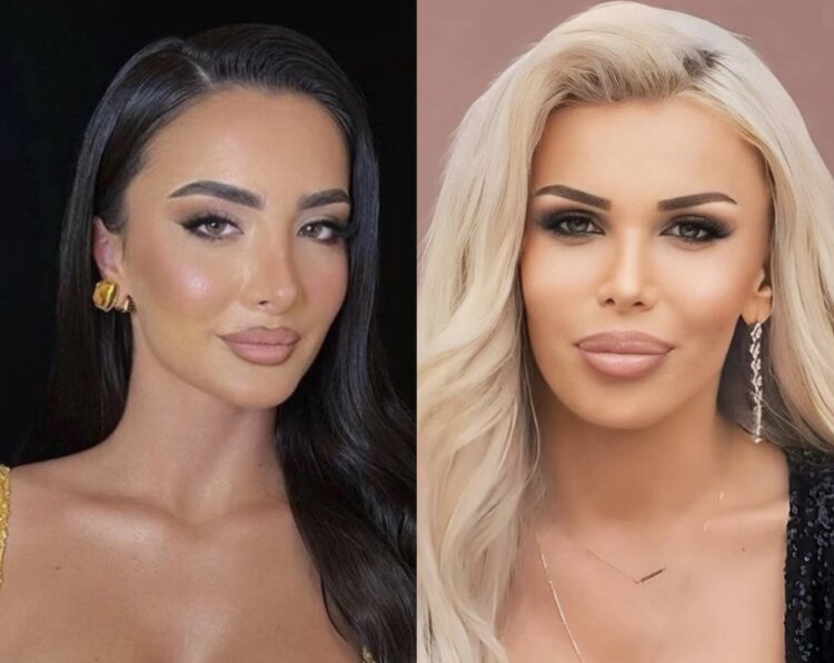 Çfarë ndodhi mes Edonës dhe Albës në “BBVK”?