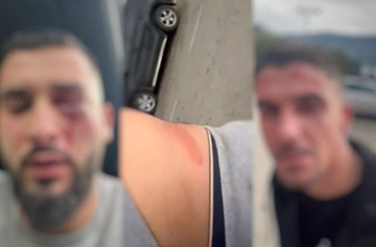 Tre shqiptarët e dhunuar në Malin e Zi rikthehen në atdhe