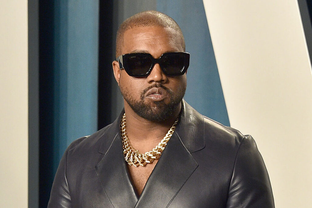 Heq dhëmbët, Kanye West vendos proteza titani me vlerë marramendëse