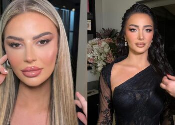 “Nuk e prisja”/ Santiana thyen heshtjen për raportin me Albën