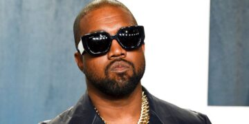 Fansat alarmohen me buzët e Kanye West pas implantit 850 mijë dollarësh
