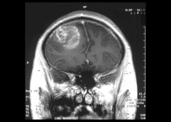 Terapia qelizore CAR-T, rezultate pozitive për të luftuar kancerin