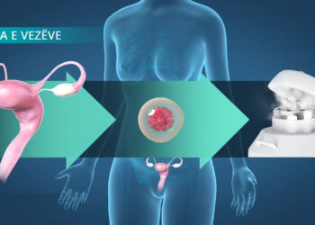 Pse gjithnjë e më shumë vajzat po ngrijnë vezët? Mësoni të vërtetën