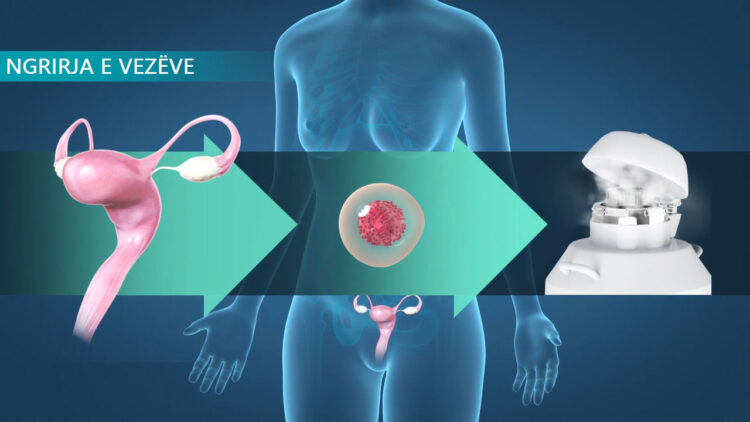 Pse gjithnjë e më shumë vajzat po ngrijnë vezët? Mësoni të vërtetën