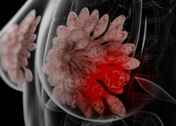 Ka shpresë! Studiuesit zbulojnë metodën që lufton kancerin e gjirit