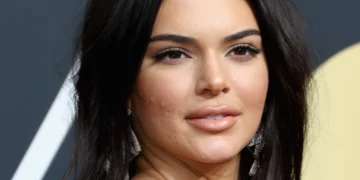 I dinit?! Këto janë ushqimet që shkaktojnë akne