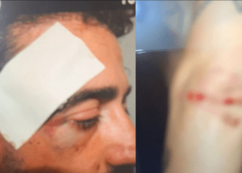 S’pranonin martesën, i riu në Durrës dhunohet nga babai dhe xhaxhai i të dashurës