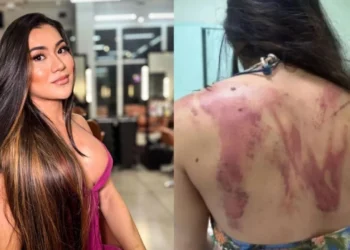 E rëndë/ Babai rreh barbarisht vajzën 33-vjeçare me hanxhar