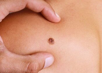 Shikoni pozicionin e nishanit dhe mësoni kuptimin e tij