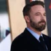 Kirurgu i operacioneve estetike: Ben Affleck po plaket nga stresi