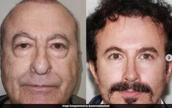 I moshuari transformohet nga operacionet,e vërteta pas pamjeve që po çmendin rrjetin