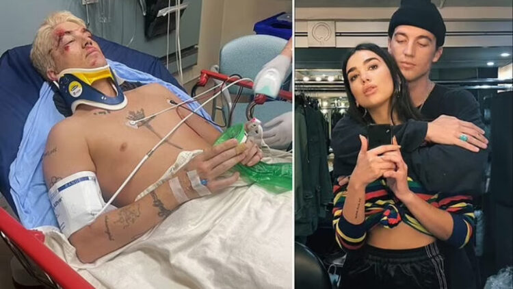 Ish-i dashuri i Dua Lipës, Paul Klein përfundon në spital pas një aksidenti të rëndë