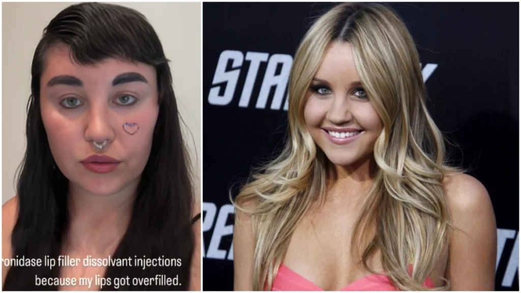 Harrojeni vajzën e buzëqeshur të “Nickeldeon”, fansat tronditen nga Amanda Bynes