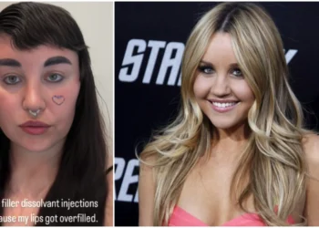 Harrojeni vajzën e buzëqeshur të “Nickeldeon”, fansat tronditen nga Amanda Bynes
