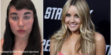 Harrojeni vajzën e buzëqeshur të “Nickeldeon”, fansat tronditen nga Amanda Bynes