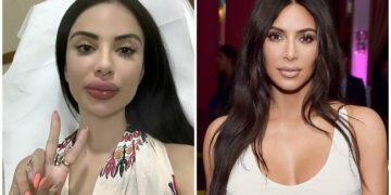 Donte të dukej si Kim Kardashian! E reja merr lajmin rrëqethës