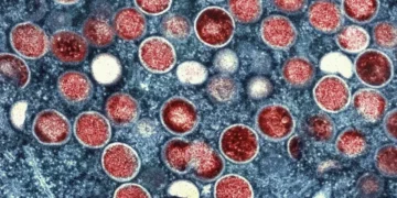 Zbulohet një virus i ri vdekjeprurës, çfarë paralajmëron OBSH?