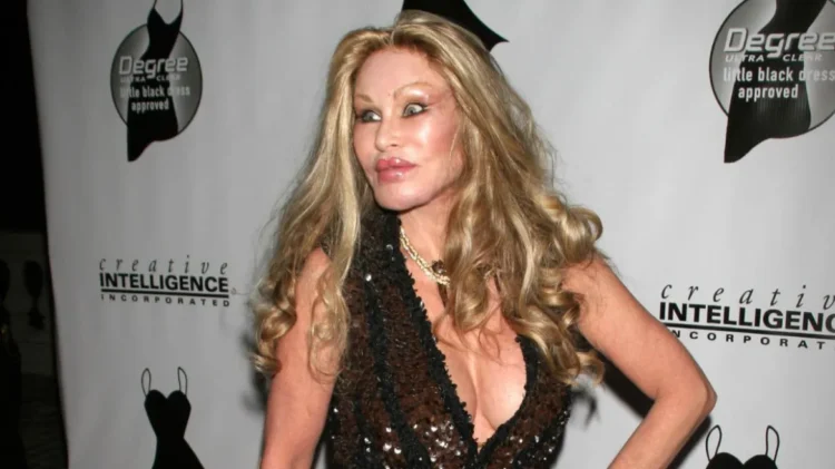 ‘Catwoman’ Jocelyn Wildenstein tregon se si dukej para operacioneve plastike