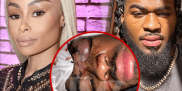 Blac Chyna paditet për dhunë në familje nga ish i dashuri