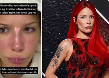 Halsey vuan nga shpërthimi i lupusit pas performancës së VMA-s