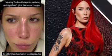 Halsey vuan nga shpërthimi i lupusit pas performancës së VMA-s