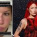Halsey vuan nga shpërthimi i lupusit pas performancës së VMA-s