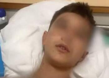 Shoku i Martinit, Luis Meçe flet nga spitali: Kam plagë nga dy thika të ndryshme!