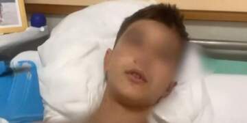 Shoku i Martinit, Luis Meçe flet nga spitali: Kam plagë nga dy thika të ndryshme!