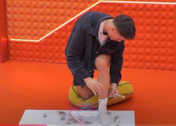 “Vetullat, këmbët, flokët”/Banorët heqin qimet nga trupi për të fituar një shpërblim