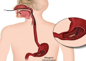Studimi: Pijet e nxehta rrisin rrezikun për zhvillim të kancerit në ezofag